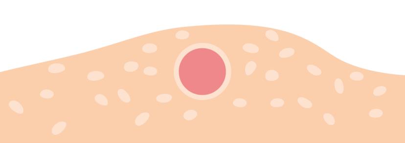 Illustration of cells and eggs in ovary tissue